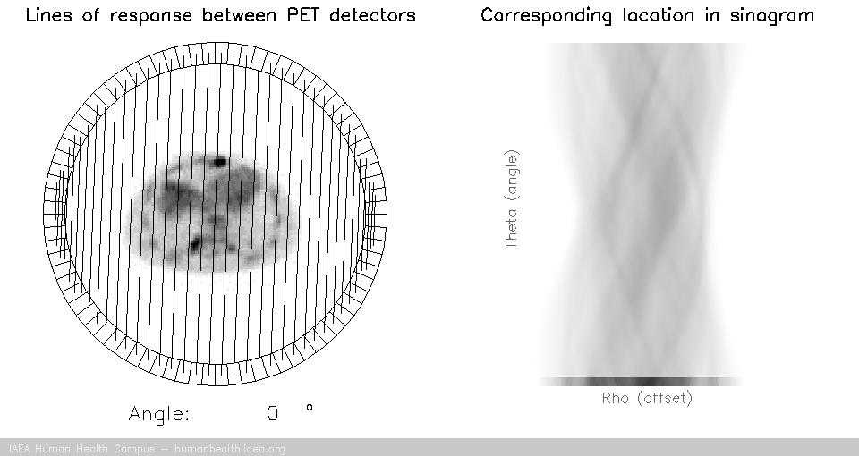 Tomo - PET - Lines of Response Tomo - PET - Lines of Response