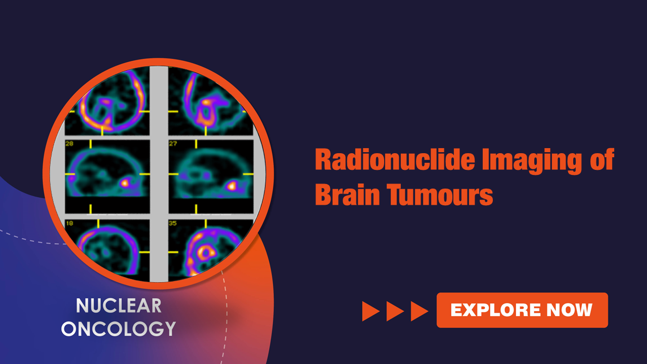 radionuclide_imaging_of_brain_tumours.png