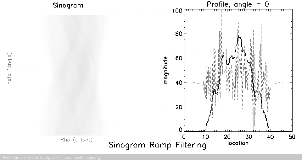 Sino Ramp Filtering Sino Ramp Filtering