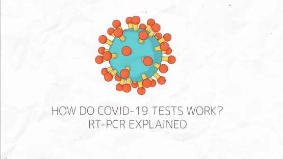 Les tests de dépistage de la COVID 19 : de quoi s’agit-il ? Qu’est ce que la RT-PCR ?
